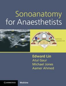 Download Sonoanatomy for Anaesthetists (Cambridge Medicine (Paperback)) pdf, epub, ebook