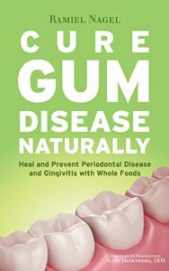 Download Cure Gum Disease Naturally: Heal and Prevent Periodontal Disease and Gingivitis with Whole Foods pdf, epub, ebook