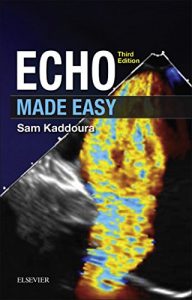 Download Echo Made Easy pdf, epub, ebook