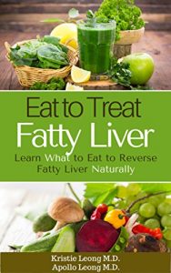 Download Fatty Liver Diet: Eat to Treat Fatty Liver pdf, epub, ebook