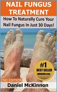 Download Nail Fungus Treatment: How To Naturally Cure Your Nail Fungus In Just 30 Days (2nd Edition) pdf, epub, ebook
