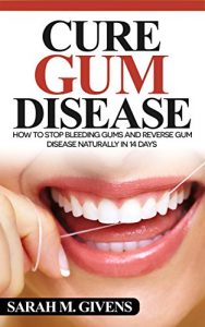 Download Gum Disease Cure (Gum Disease Cure, Periodontal Disease, Gum Disease, Gum Infection, Gingivitis treatment, Tooth Decay) pdf, epub, ebook