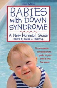 Download Babies with Down Syndrome: A New Parents’ Guide pdf, epub, ebook